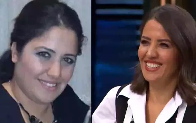 Azize Operation MasterChef Azize'nin kilolu hali ortaya çıktı. Yaptırdığı estetikleri ...