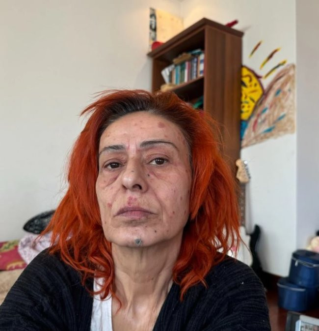 yildiztilbe.jpg