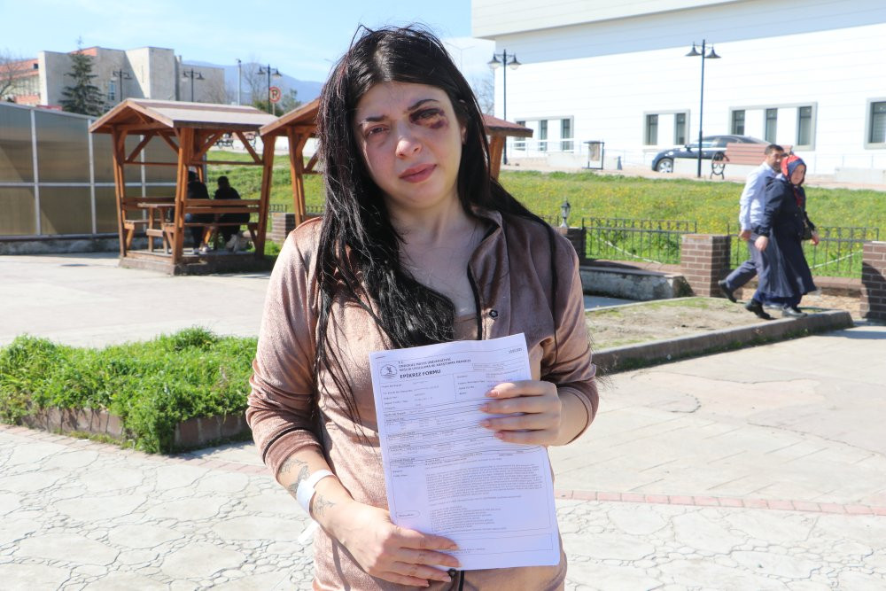 Sokak ortasında darp edilmişti! Damla olaydan sonra acı ger&ccedil;eği a&ccedil;ıkladı...