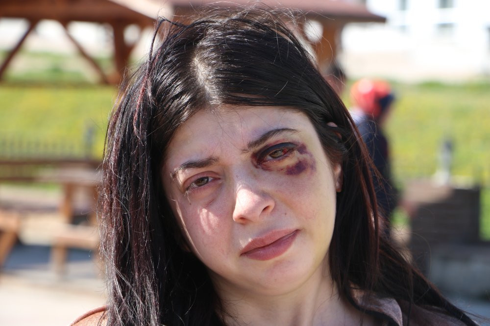 Sokak ortasında darp edilmişti! Damla olaydan sonra acı ger&ccedil;eği a&ccedil;ıkladı...